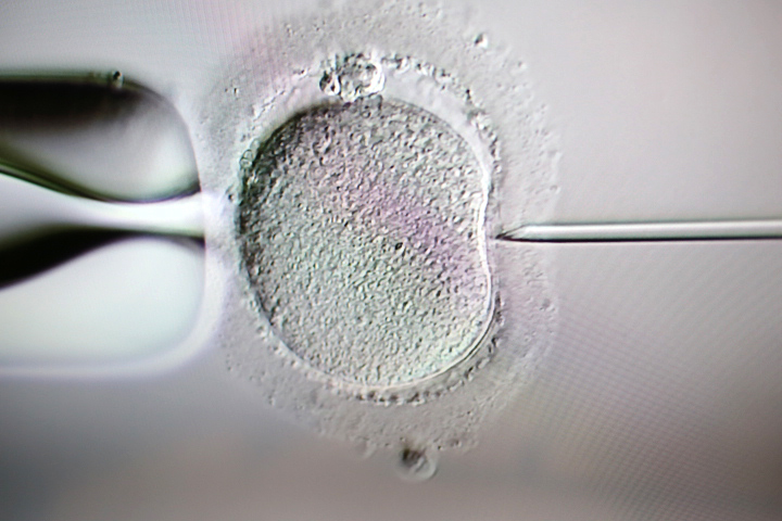 Fertility First IVF