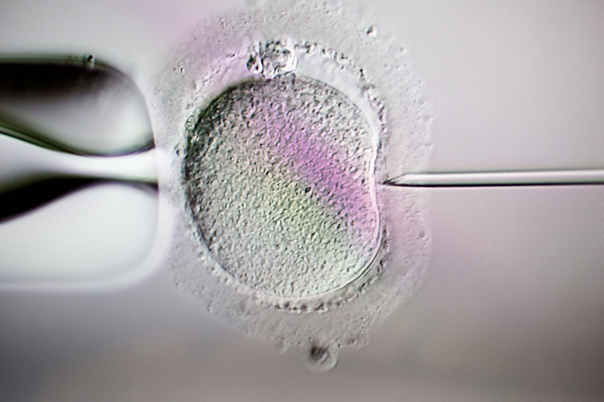 Fertility First - IVF